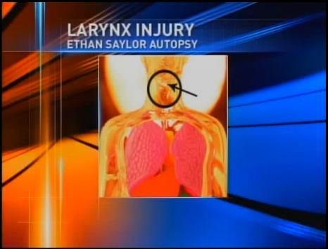Ethan Saylor throat injury